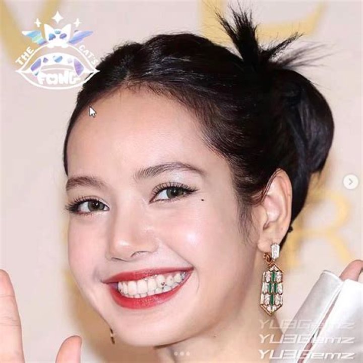 歯にダイヤモンド 芸能人